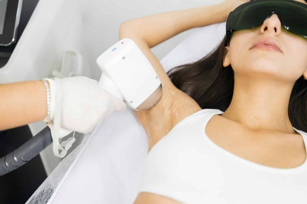 Epilation laser : le centre de choix à Marseille pour des résultats visibles et durables !